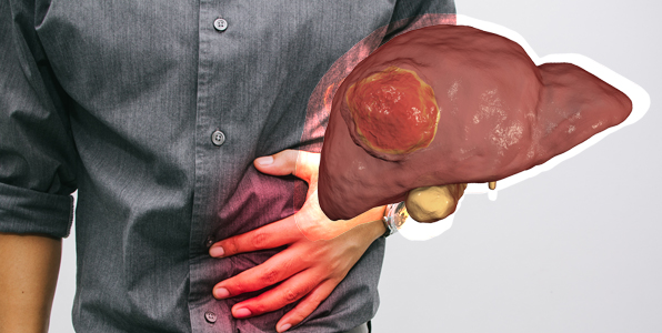 肝臓 の 腫れ 触診